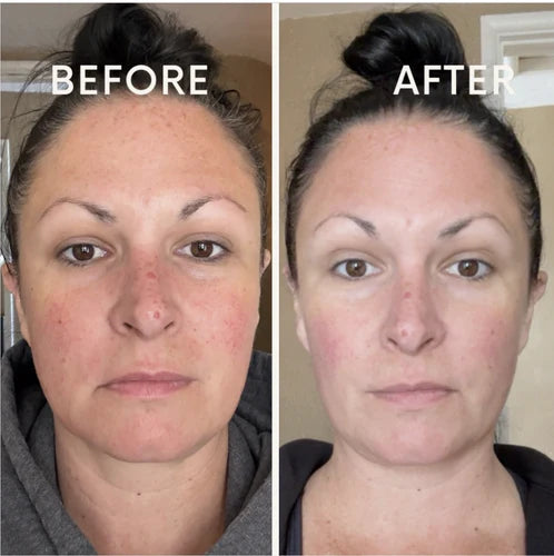 Lift & Glow Lymphatic Brush - Sculpt & Refresh Your Skin!